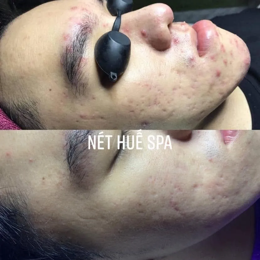 SPA NÉT HUẾ